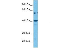 Host:  Rabbit  Target Name:  KCNK9  Sample Tissue:  Human Hela Whole Cell  Antibody Dilution:  1ug/ml (KCNK9 anticorps  (N-Term))