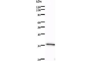 Western Blotting (WB) image for anti-LIM Domain Only 1 (Rhombotin 1) (LMO1) antibody (ABIN932474) (LMO1 anticorps)