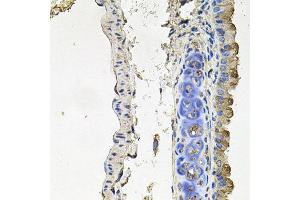 Immunohistochemistry of paraffin-embedded mouse lung using NDUFA6 antibody at dilution of 1:100 (x40 lens). (NDUFA6 anticorps)