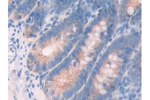 Detection of MYL6B in Rat Small intestine Tissue using Polyclonal Antibody to Myosin Light Chain 6B, Alkali, Smooth Muscle And Non Muscle (MYL6B)