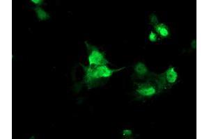 Image no. 2 for anti-Family With Sequence Similarity 119A (FAM119A) antibody (ABIN1498598)