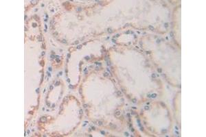 IHC-P analysis of Human Tissue, with DAB staining. (FGF13 anticorps  (AA 63-245))