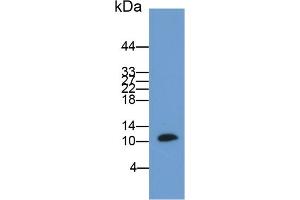 Detection of S100B in Rat Cerebrum lysate using Polyclonal Antibody to S100 Calcium Binding Protein B (S100B) (S100B anticorps  (AA 1-92))