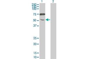 Western Blot analysis of ENPP5 expression in transfected 293T cell line by ENPP5 monoclonal antibody (M01), clone 1C5-1D7. (ENPP5 anticorps  (AA 24-477))