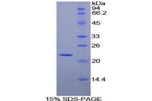 SDS-PAGE analysis of Mouse HSPb2 Protein. (HSPB2 Protéine)