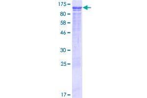 Image no. 1 for CREB3 Regulatory Factor (CREBRF) (AA 1-639) protein (GST tag) (ABIN1347590)