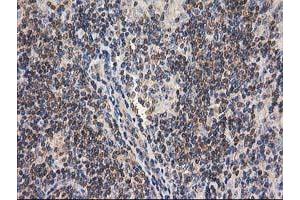 Image no. 12 for anti-Glucosidase, Beta, Acid 3 (Cytosolic) (GBA3) (AA 1-150), (AA 370-469) antibody (ABIN1490582)