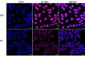 Immunocytochemical staining of HeLa cells using EHMT2 antibody (ABIN7797609), 1:1,000), Top panel: wild-type (WT), Bottom panal: EHMT2 shRNA knockdown (KD). (Recombinant EHMT2 anticorps)