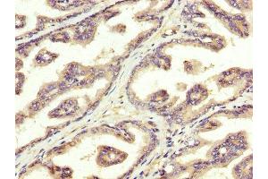 IHC image of ABIN7170778 diluted at 1:300 and staining in paraffin-embedded human prostate tissue performed on a Leica BondTM system.