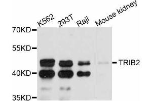 Western blot analysis of extracts of various cell lines, using TRIB2 antibody (ABIN5999100) at 1:3000 dilution. (TRIB2 anticorps)