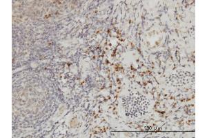Immunoperoxidase of monoclonal antibody to CSE1L on formalin-fixed paraffin-embedded human tonsil. (Exportin 2 anticorps  (AA 872-971))