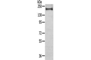 Gel: 6 % SDS-PAGE,Lysate: 40 μg,Primary antibody: ABIN7191116(IQGAP2 Antibody) at dilution 1/350 dilution,Secondary antibody: Goat anti rabbit IgG at 1/8000 dilution,Exposure time: 20 seconds (IQGAP2 anticorps)