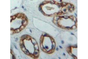 Used in DAB staining on fromalin fixed paraffin-embedded Kidney tissue