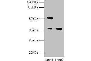 Western blot All lanes: IMPACT antibody at 10 μg/mL Lane 1: Hela whole cell lysate Lane 2: HL60 whole cell lysate Secondary Goat polyclonal to rabbit IgG at 1/10000 dilution Predicted band size: 37, 23 kDa Observed band size: 37, 52 kDa (IMPACT anticorps  (AA 41-320))