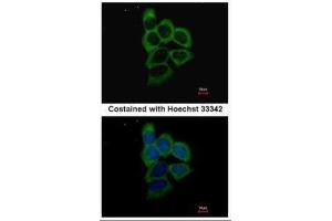 ICC/IF Image Immunofluorescence analysis of methanol-fixed A431, using PSMD2, antibody at 1:500 dilution. (PSMD2 anticorps)