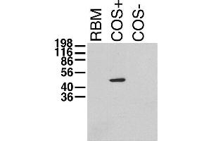 Immunoblot on adult rat brain membrane (RBM) and lysates from Kvβ1.