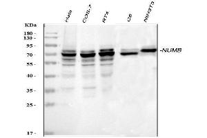 Western blot analysis of NUMB using anti-NUMB antibody (ABIN3043374). (NUMB anticorps  (N-Term))