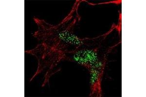 Fluorescent confocal image of SY5Y cells stained with KLF4 antibody at 1:100. (KLF4 anticorps  (AA 69-101))