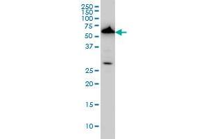 AAAS monoclonal antibody (M02), clone 5A1 Western Blot analysis of AAAS expression in HeLa (ABIN1339522).