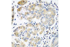 Immunohistochemistry of paraffin-embedded human stomach using PLS3 antibody.