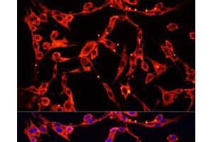 Immunofluorescence analysis of PC-12 cells using AOC1 Polyclonal Antibody at dilution of 1:100 (40x lens).