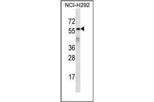 Western blot analysis of ODF2L Antibody (C-term) in NCI-H292 cell line lysates (35ug/lane). (ODF2L anticorps  (C-Term))