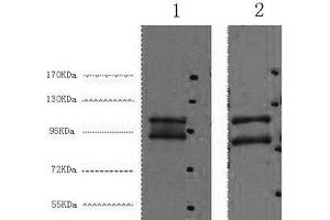 Western Blot analysis of 1) Hela, 2) HepG2 cells using IDE Monoclonal Antibody at dilution of 1:2000. (IDE anticorps)