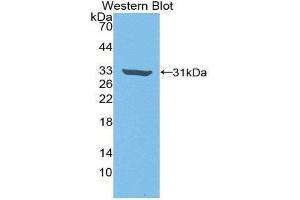 Western Blotting (WB) image for anti-rho-Associated, Coiled-Coil Containing Protein Kinase 2 (ROCK2) (AA 904-1140) antibody (ABIN3205961) (ROCK2 anticorps  (AA 904-1140))