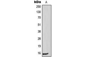 Western blot analysis of PIG11 expression in HuvEc (A) whole cell lysates. (TP53I11 anticorps  (Center))
