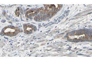 ABIN6275121 at 1/100 staining Human prostate tissue by IHC-P. (EIF3F anticorps  (Internal Region))