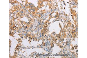Immunohistochemistry of Human brain  using ACTR2 Polyclonal Antibody at dilution of 1:40 (ACTR2 anticorps)