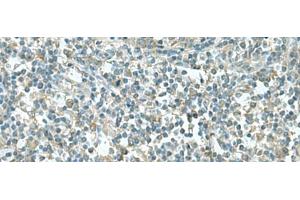 Immunohistochemistry of paraffin-embedded Human tonsil tissue using CCT5 Polyclonal Antibody at dilution of 1:55(x200) (CCT5 anticorps)