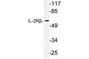 Western blot analysis of IL-2Rβ antibody in extracts from RAW264. (IL2 Receptor beta anticorps)