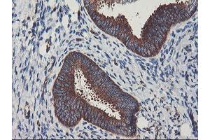 Image no. 3 for anti-phosphofructokinase, Platelet (PFKP) antibody (ABIN1500164)