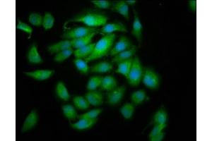 Immunofluorescence staining of A549 cells with ABIN7153444 at 1:133, counter-stained with DAPI. (Galectin 10 anticorps  (AA 2-142))