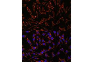 Immunofluorescence analysis of L929 cells using 43716 antibody (ABIN7265350) at dilution of 1:100.