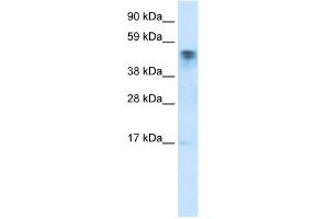WB Suggested Anti-FLJ13798 Antibody Titration:  0. (FLJ13798 (FLJ13798) (C-Term) anticorps)