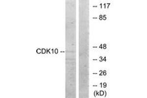 Western Blotting (WB) image for anti-Cyclin-Dependent Kinase 10 (CDK10) (AA 51-100) antibody (ABIN2889602) (CDK10 anticorps  (AA 51-100))
