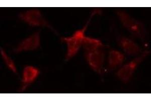 ABIN6275891 staining  HeLa cells by IF/ICC. (NR1I2 anticorps  (Internal Region))