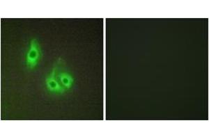 Immunofluorescence analysis of HepG2 cells, using LAMA3 Antibody. (LAMA3 anticorps  (AA 2571-2620))