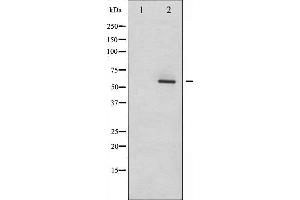 Western blot analysis of Dab1 phosphorylation expression in LOVO whole cell lysates,The lane on the left is treated with the antigen-specific peptide.