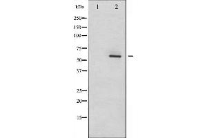 Western blot analysis of Dab1 phosphorylation expression in LOVO whole cell lysates,The lane on the left is treated with the antigen-specific peptide. (DAB1 anticorps  (pTyr232))