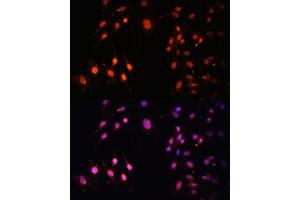 Immunofluorescence analysis of C6 cells using SETD2 Polyclonal Antibody (ABIN3017564, ABIN3017565, ABIN1682666 and ABIN6220156) at dilution of 1:100 (40x lens).
