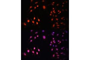 Immunofluorescence analysis of C6 cells using SETD2 Polyclonal Antibody (ABIN3017564, ABIN3017565, ABIN1682666 and ABIN6220156) at dilution of 1:100 (40x lens). (SETD2 anticorps  (AA 803-1103))