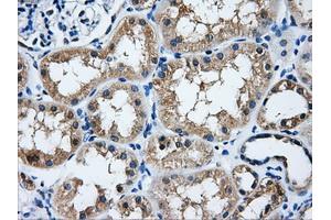 Immunohistochemical staining of paraffin-embedded liver tissue using anti-HDAC10mouse monoclonal antibody. (HDAC10 anticorps)