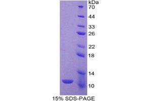 SDS-PAGE analysis of Rat IDO Protein. (IDO Protéine)