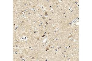 IHC analysis of APLP1 using anti-APLP1 antibody (ABIN3043786).