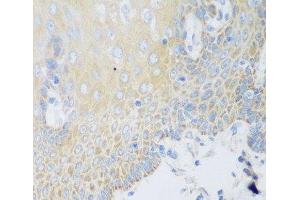 Immunohistochemistry of paraffin-embedded Human esophagus using DHODH Polyclonal Antibody at dilution of 1:100 (40x lens). (DHODH anticorps)