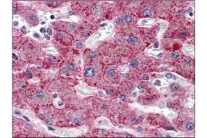 Immunohistochemistry (IHC) image for anti-Serpin Peptidase Inhibitor, Clade G (C1 Inhibitor), Member 1 (SERPING1) (AA 1-501) antibody (ABIN782340)