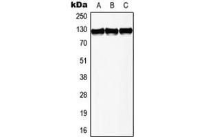 Western blot analysis of Telomerase expression in Jurkat (A), Raw264. (TERT anticorps  (Center))